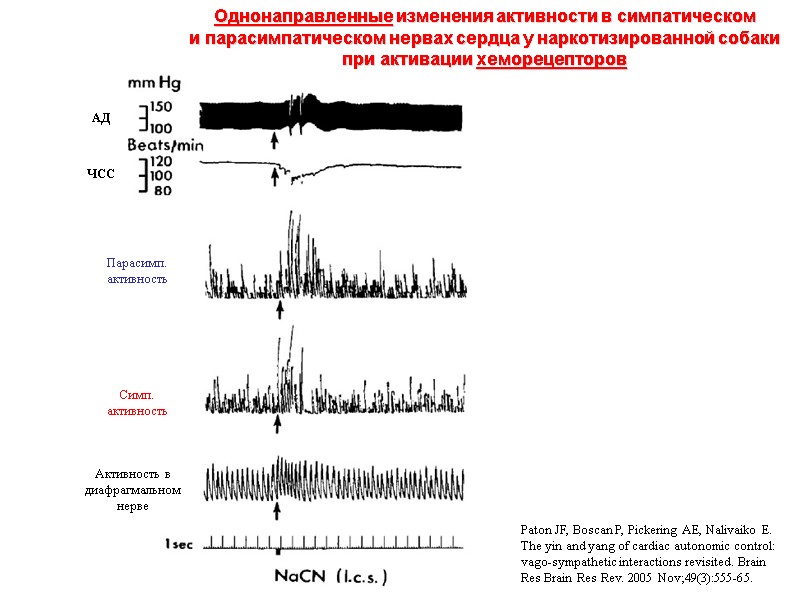 Paton JF, Boscan P, Pickering AE, Nalivaiko E. The yin and yang of cardiac